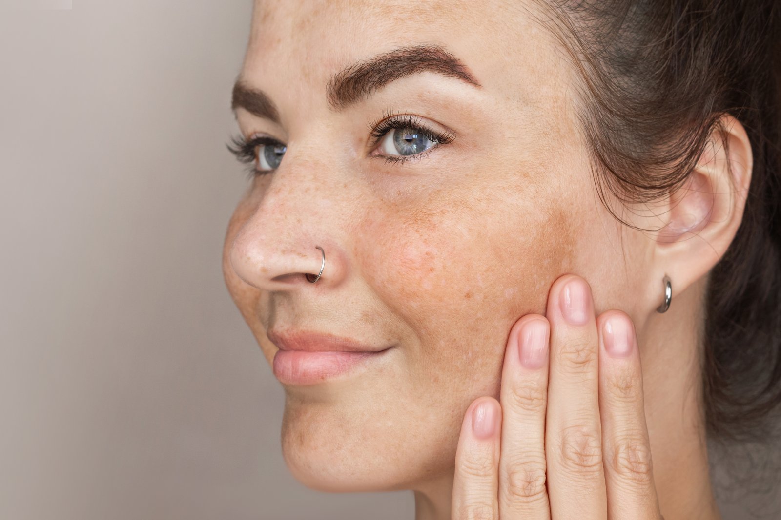 taches brunes visage