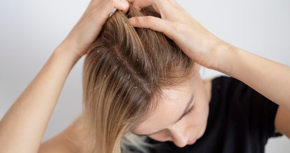 Cuir chevelu qui gratte sans pellicules