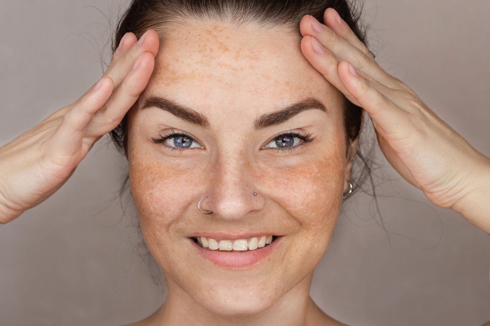 البقع الداكنة في الوجه