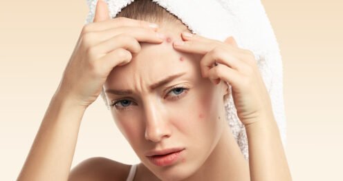 excès de sébum sur le visage