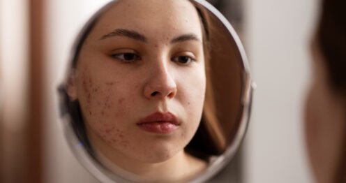 روتين يومي لازالة البقع الداكنة