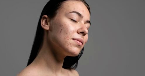 الحبوب والبقع الداكنة