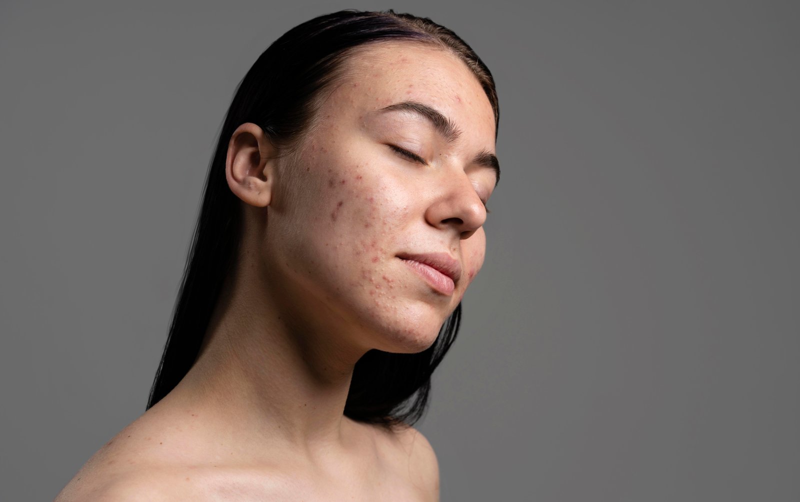 الحبوب والبقع الداكنة