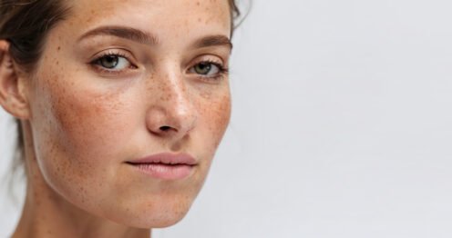 كيف أزيل البقع الداكنة من الوجه